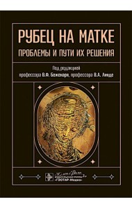 Рубец на матке: проблемы и пути их решения
