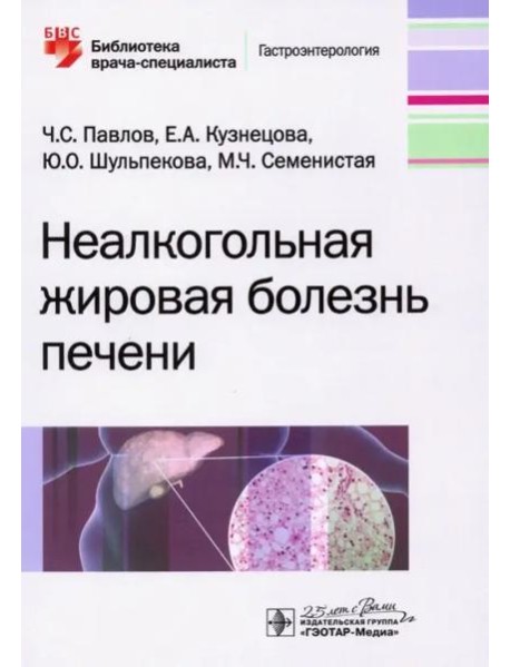 Неалкогольная жировая болезнь печени