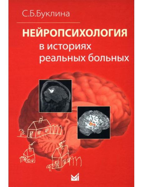 Нейропсихология в историях реальных больных