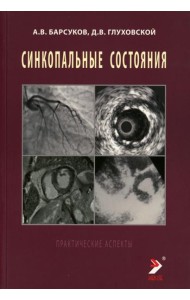 Синкопальные состояния: практические аспекты