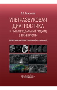 Ультразвуковая диагностика и мультимодальный подход в маммологии. Диффузные неузловые патологии (non-mass lesions)