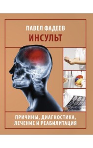 Инсульт. Причины, диагностика, лечение и реабилитация