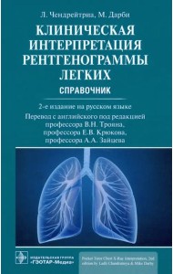 Клиническая интерпретация рентгенограммы легких. Справочник