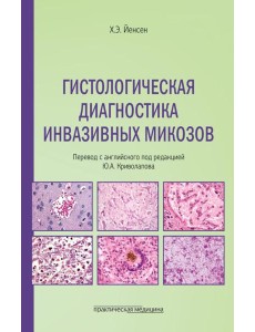 Гистологическая диагностика инвазивных микозов