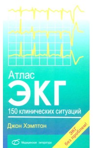 Атлас ЭКГ: 150 клинических ситуаций