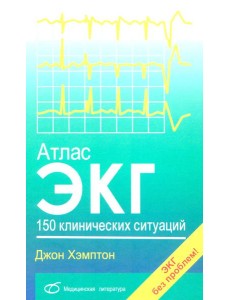 Атлас ЭКГ: 150 клинических ситуаций