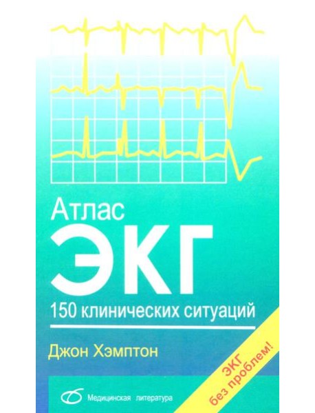 Атлас ЭКГ: 150 клинических ситуаций
