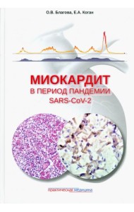 Миокардит в период пандемии SARS-CoV-2