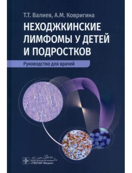 Неходжкинские лимфомы у детей и подростков