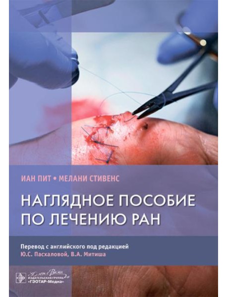 Наглядное пособие по лечению ран