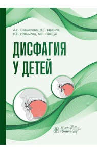 Дисфагия у детей