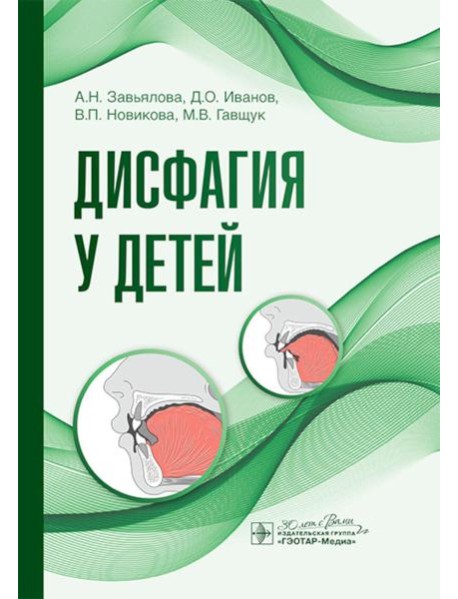 Дисфагия у детей