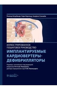 Имплантируемые кардиовертеры-дефибрилляторы. Иллюстрированное пошаговое руководство