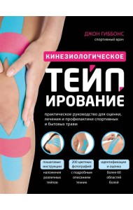 Кинезиологическое тейпирование