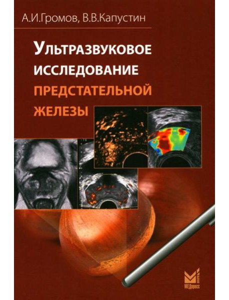 Ультразвуковое исследование предстательной железы