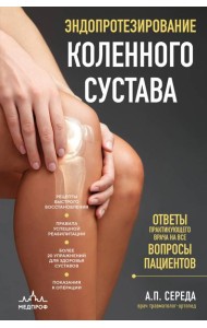 Эндопротезирование коленного сустава: ответы практикующего врача на все вопросы пациентов