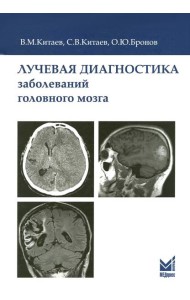 Лучевая диагностика заболеваний головного мозга