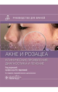 Акне и розацеа. Клинические проявления, диагностика и лечение: руководство для врачей. 2-е изд., перераб. и доп