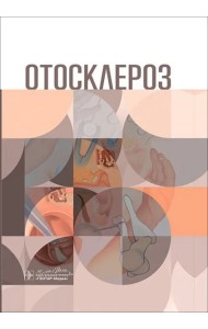 Отосклероз