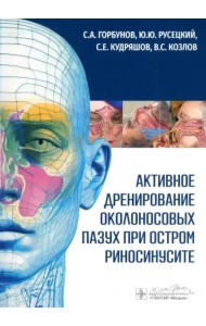 Активное дренирование околоносовых пазух при остром риносинусите