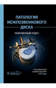 Патология межпозвонкового диска. Поясничный отдел
