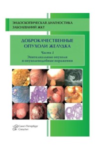 Доброкачественные опухоли желудка. Ч. 1: Эпителиальные опухоли и опухолеподобные поражения: Учебно-методическое пособие. 2-е изд., испр. и доп