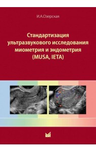 Стандартизация ультразвукового исследования миометрия и эндометрия (MUSA, IETA): Учебное пособие. 2-е изд