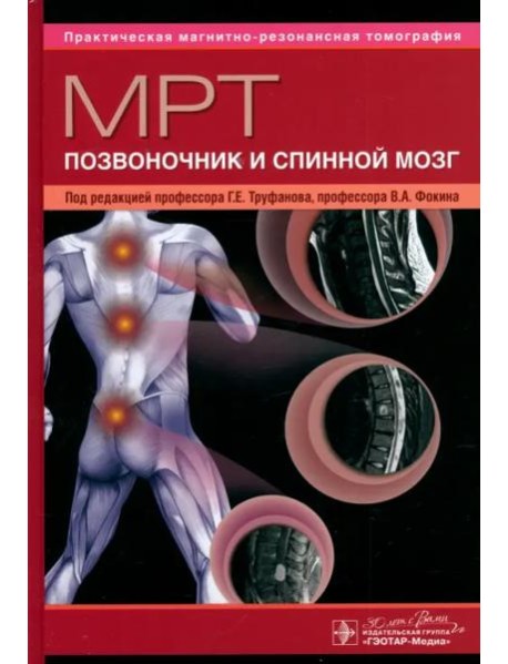 МРТ. Позвоночник и спинной мозг. Руководство для врачей