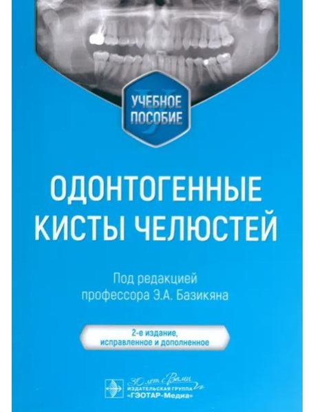 Одонтогенные кисты челюстей