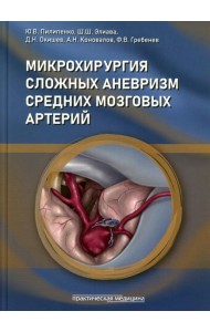 Микрохирургия сложных аневризм средних мозговых артерий: гигантских, фузиформных и частично тромбированных