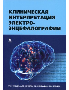 Клиническая интерпретация электроэнцефалографии