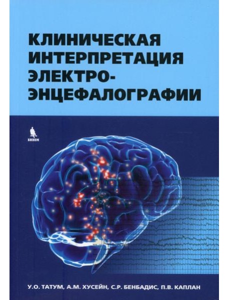 Клиническая интерпретация электроэнцефалографии