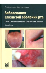 Заболевания слизистой оболочки рта. Связь с общей патологией. Диагностика. Лечение
