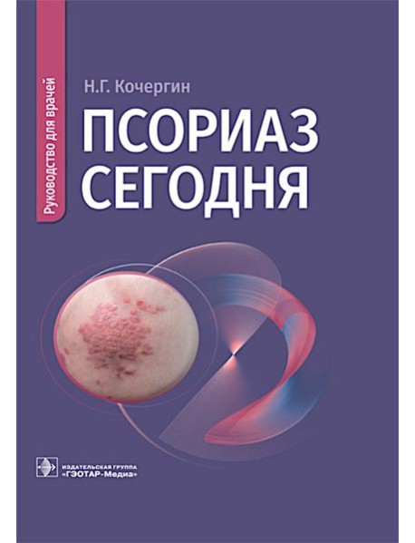 Псориаз сегодня: руководство для врачей