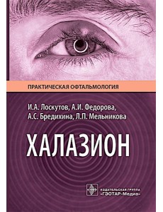 Халазион Халазион