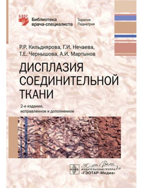 Дисплазия соединительной ткани. 2-е изд., испр. и доп
