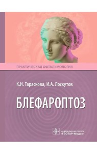 Блефароптоз