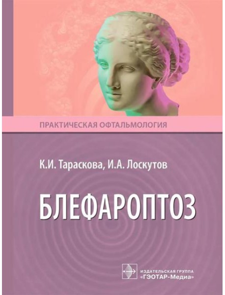 Блефароптоз