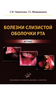 Болезни слизистой оболочки рта: атлас
