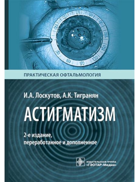 Астигматизм. 2-е изд., перераб. и доп