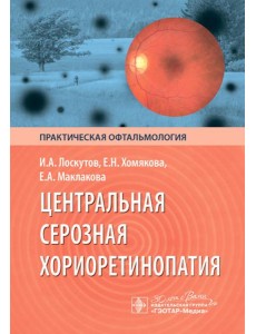 Центральная серозная хориоретинопатия