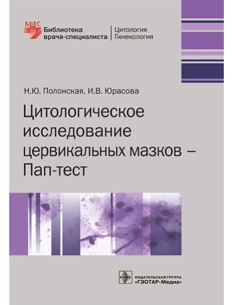 Цитологическое исследование цервикальных мазков — Пап-тест