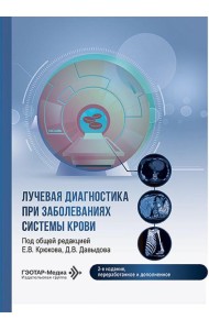 Лучевая диагностика при заболеваниях системы крови . 2-е изд., перераб. и доп