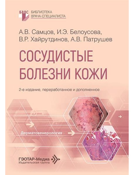 Сосудистые болезни кожи. 2-е изд., перераб. и доп