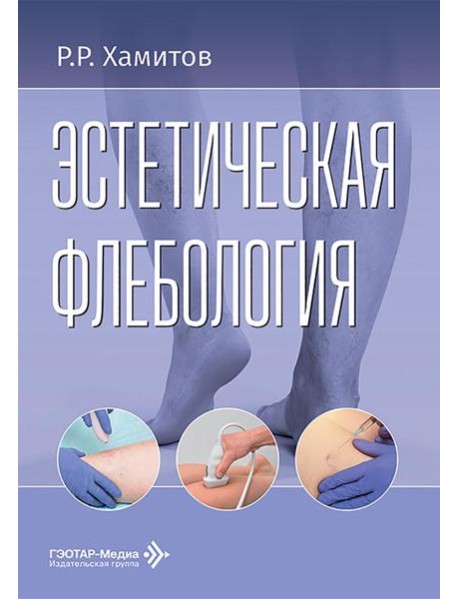 Эстетическая флебология