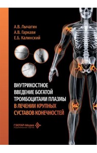 Внутрикостное введение богатой тромбоцитами плазмы в лечении крупных суставов конечностей