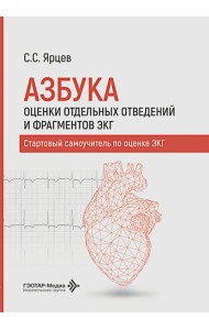 Азбука оценки отдельных отведений и фрагментов ЭКГ. Стартовый самоучитель по оценке ЭКГ