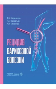 Рецидив варикозной болезни