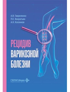 Рецидив варикозной болезни Рецидив варикозной болезни
