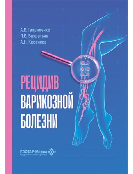 Рецидив варикозной болезни